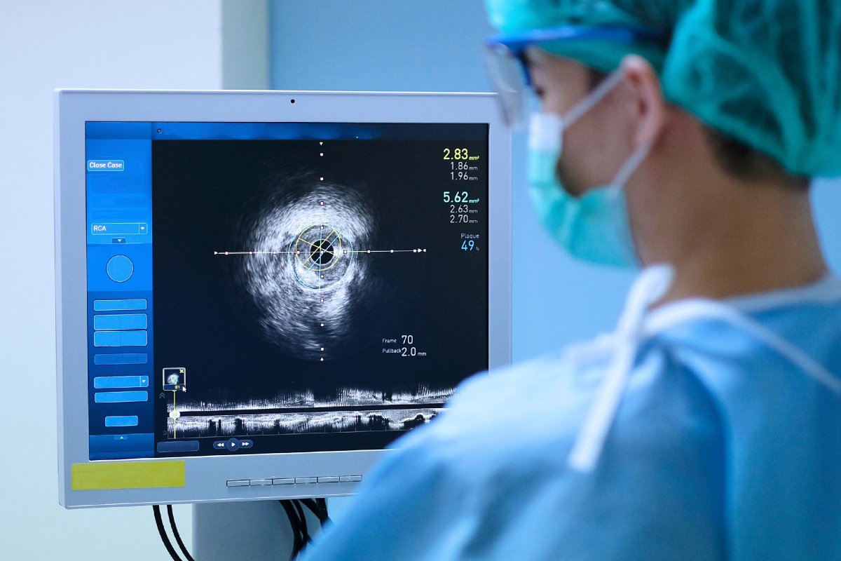 AMD Tech Accelerates Premium Medical Imaging